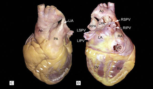 External Anatomy Elderly